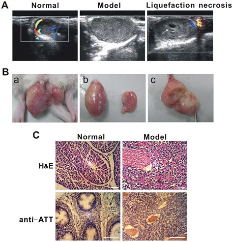 small soft lumo testes|lump on testicle cancer treatment.